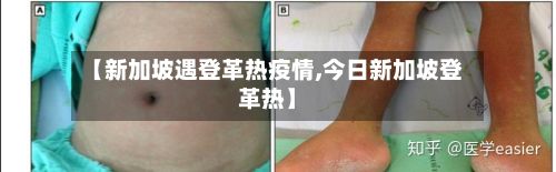 【新加坡遇登革热疫情,今日新加坡登革热】-第2张图片